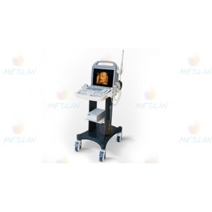 УЗ апарат iuStar 160